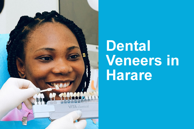 Dental Veneers in Harare