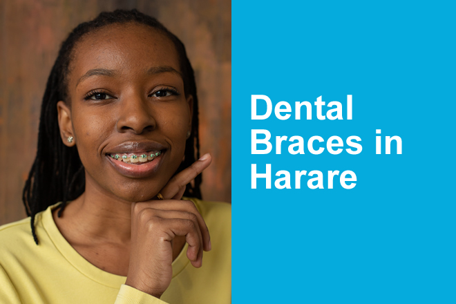 Dental Braces in Harare